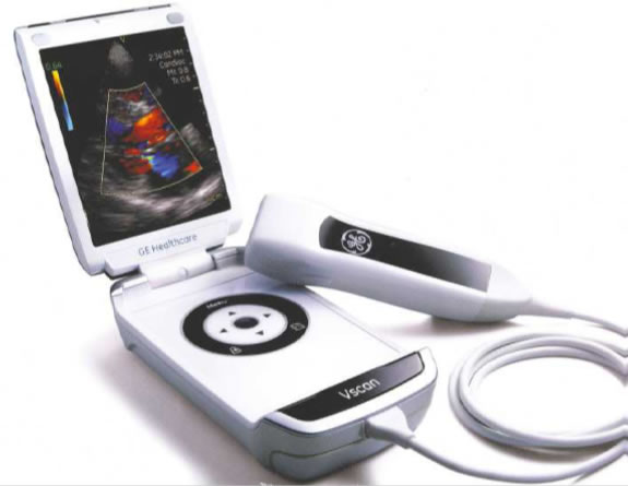 汎用超音波画像診断装置